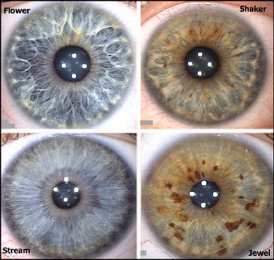 Rayid Analysis